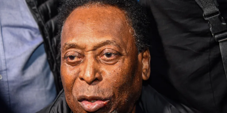Pelé, em tratamento contra o câncer, é internado ao apresentar inchaços pelo corpo