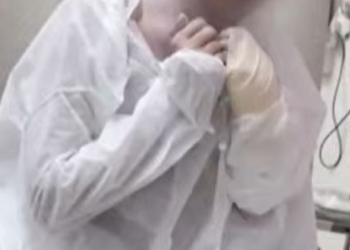 Jovem tem 70% do corpo queimado por mulher que achou que ela fosse amante do marido