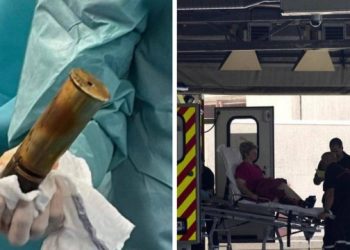 Idoso de 88 anos é internado com explosivo no ânus e hospital é evacuado