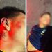 Suspeito de assalto é linchado pela população e leva tiro de ‘justiceiro’ em Manaus