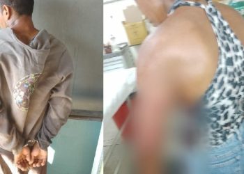 Homem quase tira pedaço do braço da ex com peixeira no AM por não aceitar separação