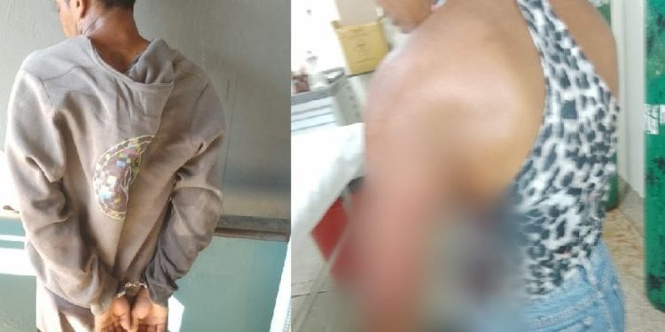 Homem quase tira pedaço do braço da ex com peixeira no AM por não aceitar separação