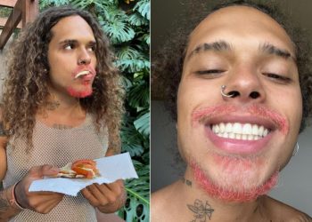 Vitão surpreende internautas e aparece com barba e bigode rosa nas redes sociais