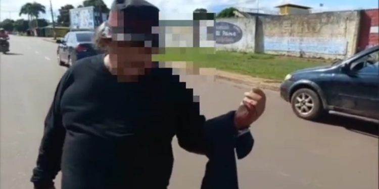 Homem leva facada da esposa no interior do Amazonas e ele a perdoa; veja vídeo