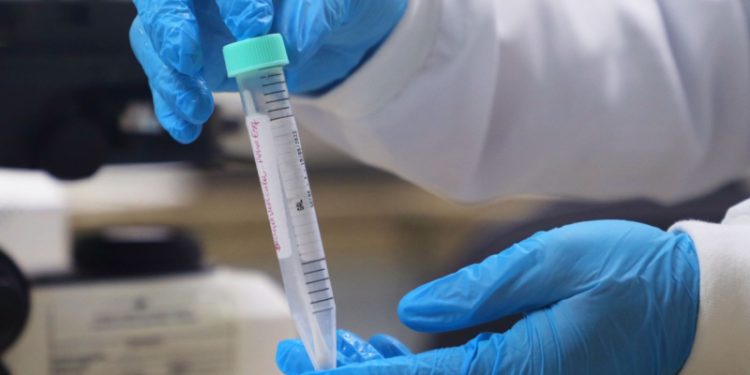 Saúde divulga boletins da Covid-19, Mpox e vacinação no Amazonas nesta sexta-feira