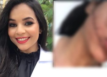 Jovem tem rosto cortado pela metade enquanto dormia em viagem de ônibus: ‘poderia estar morta’