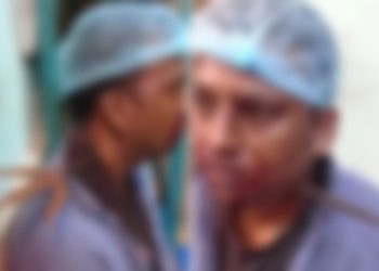 Homem tem pescoço atravessado por tridente após discussão e sobrevive: ‘nem doeu’