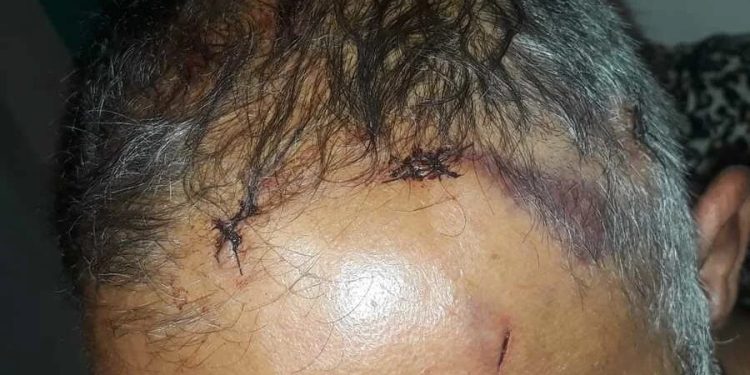 Homem é esfaqueado quatro vezes ao negar esmola: ‘maior trauma da vida’