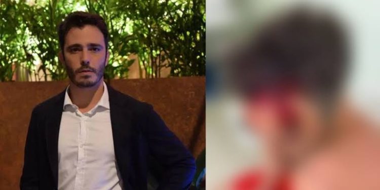 Ator da Globo apanha de assaltantes e é encontrado desacordado em praça
