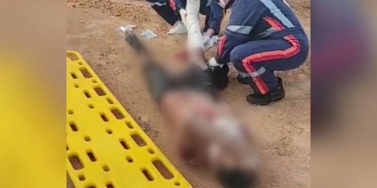 Vídeo: Jovem diz que foi confundido com assaltantes e apanhou até ter fratura exposta na perna