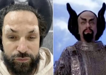 Latino faz harmonização facial e fica a cara do diabo de ‘O Auto da Compadecida’