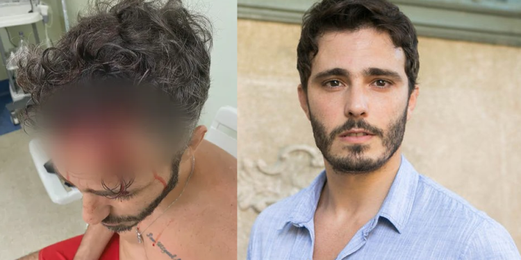 Ator Thiago Rodrigues é espancado e encontrado desacordado após sofrer assalto no RJ