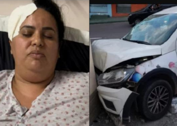 Empreendedora leva tiro na cabeça no Centro de Manaus e pede ajuda para recuperar veículo de trabalho