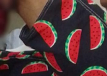 Cena forte: Motociclista cai em buraco e tem a perna dilacerada na roda em acidente no AM