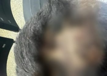 Após comer mingau da irmã, criança de 6 anos tem cabeça quebrada em Manaus