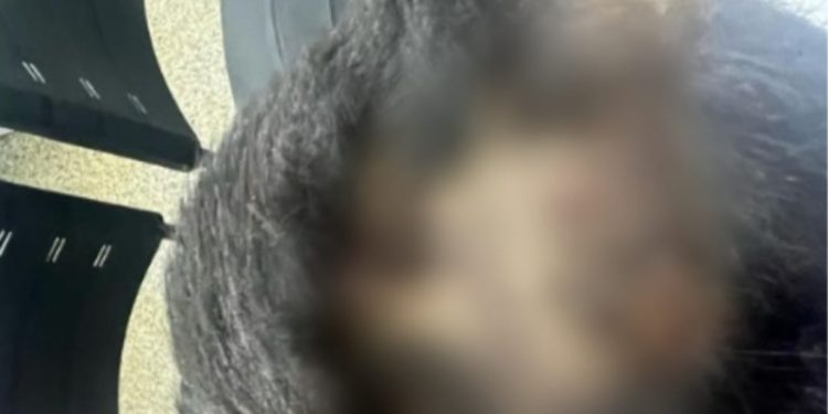 Após comer mingau da irmã, criança de 6 anos tem cabeça quebrada em Manaus