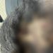 Após comer mingau da irmã, criança de 6 anos tem cabeça quebrada em Manaus