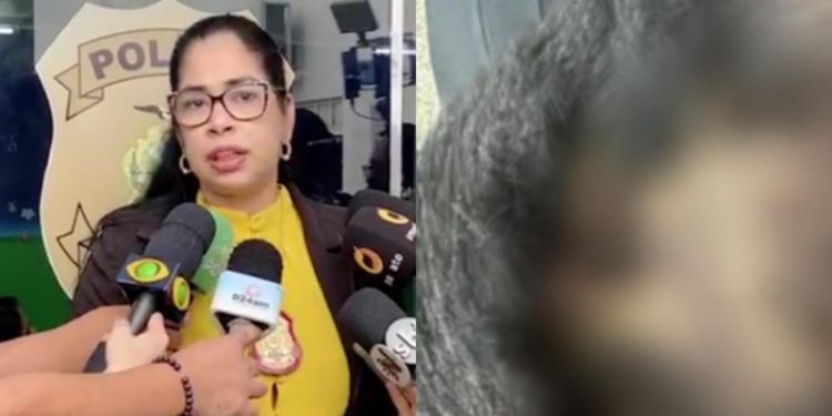 Padrasto se irrita e quebra cabeça da enteada de 6 anos com faca em Manaus