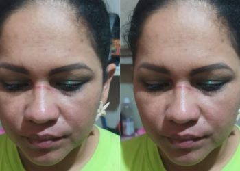 Cantora é agredida por proprietária de evento no Amazonas