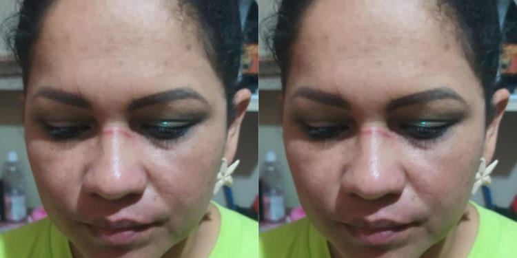 Cantora é agredida por proprietária de evento no Amazonas
