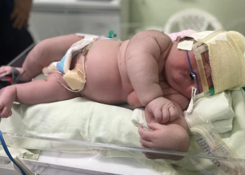 Bebê gigante nasce com mais de 7 kg em Parintins e família faz campanha para ganhar enxoval novo