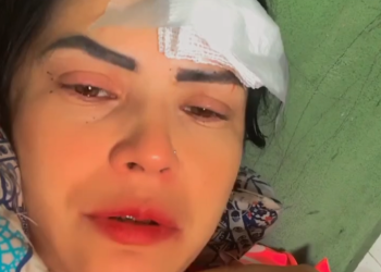 Jovem tem a cabeça rasgada em forró de Manaus após aceitar dançar com ‘boy’ e ser atacada por ‘louca’; vídeo