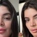 Gkay mostra antes e depois de retirar preenchimento labial, ‘tirei minha boca’, diz ela