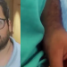 Anestesista é preso após se filmar cometendo estupros em pacientes e ainda armazenar pornografia infantil