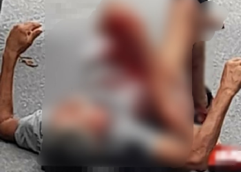 Cena forte: Homem fica com a perna dilacerada após caminhão passar por cima dele em Manaus