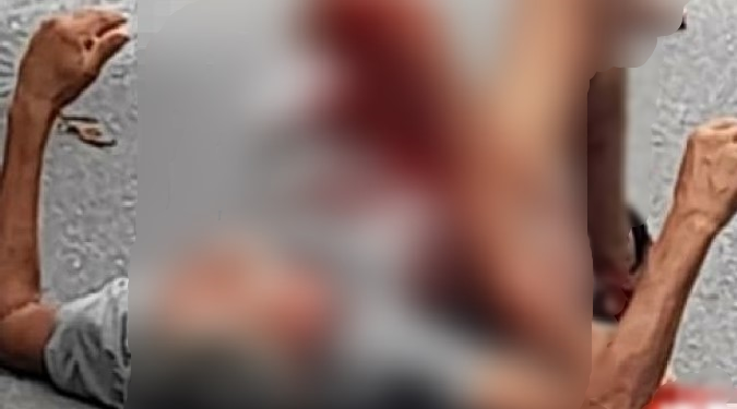 Cena forte: Homem fica com a perna dilacerada após caminhão passar por cima dele em Manaus