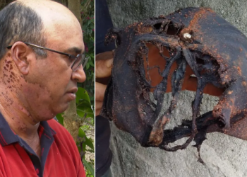 Impressionante! Pedreiro é atingido por raio na cabeça, mas sobrevive graças a boné