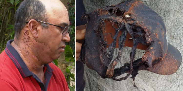 Impressionante! Pedreiro é atingido por raio na cabeça, mas sobrevive graças a boné
