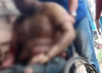 Piloto tem 80% do corpo queimado após queda de avião no AM