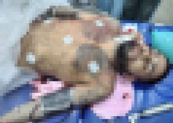 Polícia é recebida a tiros no Jorge Teixeira e homem acaba morto