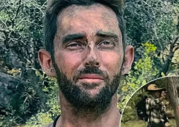 Homem queima parte íntima em reality show: ‘ficamos muito perto do fogo’