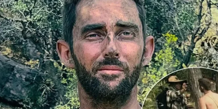 Homem queima parte íntima em reality show: ‘ficamos muito perto do fogo’