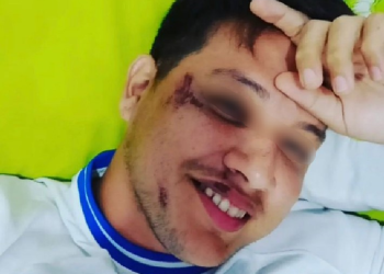 ‘Estaria desovado’, relata folião após sair da Banda da Bica e ser roubado por motorista por app