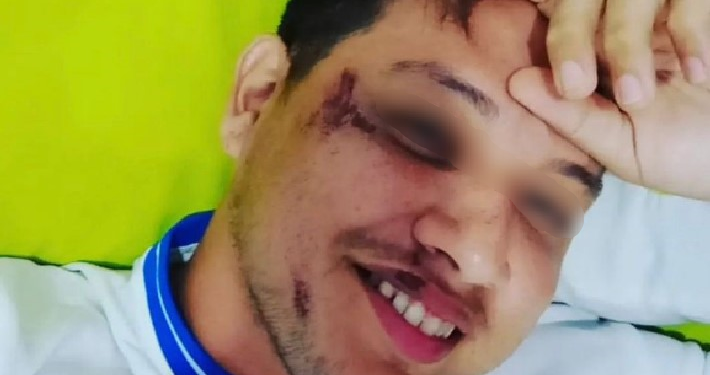 ‘Estaria desovado’, relata folião após sair da Banda da Bica e ser roubado por motorista por app