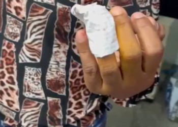 Mulher quase perde o dedo ao levar terçadada de bandido dentro do ônibus 677, em Manaus