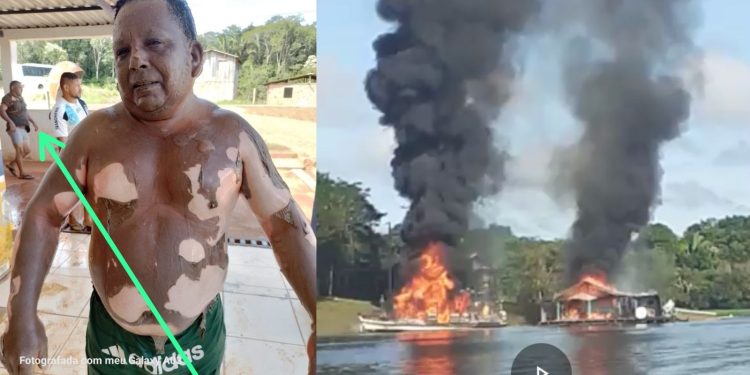 Embarcação explode e três ficam gravemente feridos