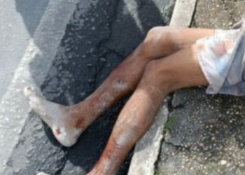 Cadáver é desovado em calçada da avenida Margarita