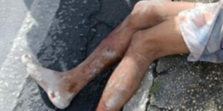 Cadáver é desovado em calçada da avenida Margarita