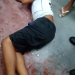 Adolescente de 15 anos é baleado durante assalto no Jorge Teixeira