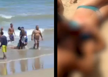 Jovem tem parte do braço decepado por tubarão; imagens fortes