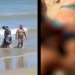 Jovem tem parte do braço decepado por tubarão; imagens fortes