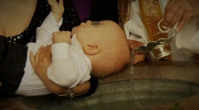 Padre acidentalmente batiza bebê de 8 meses com ácido