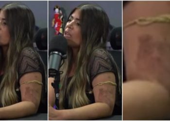 Bruna Surfistinha aparece com hematomas e diz que foi ex-marido