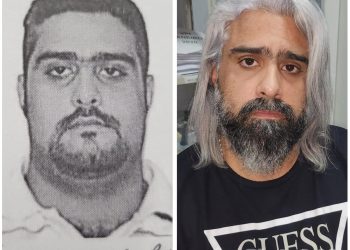 Jovem tem parte do braço decepado por tubarão; imagens fortes