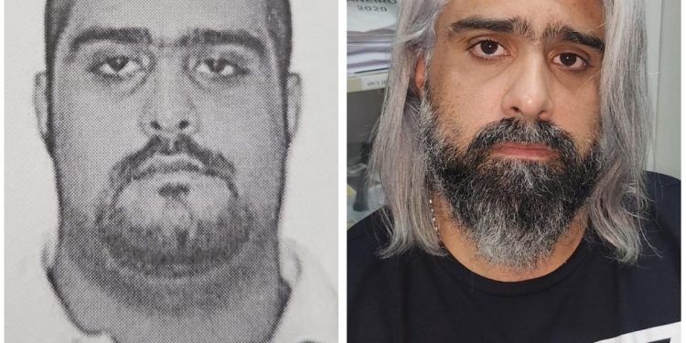 Jovem tem parte do braço decepado por tubarão; imagens fortes