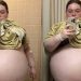 Mulher remove tumor de 47 kg do ovário: ‘grávida de 10 filhos’